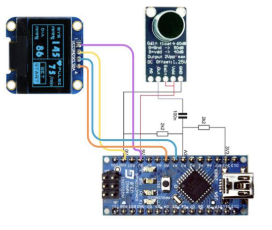 Arduino Voice Recognition